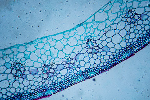 Read more about the article Market Opportunities for Hemicellulases