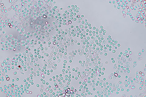 Read more about the article Yeast Beta-Glucans Market Overview